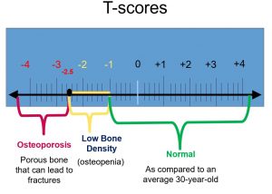 T-Score T-Score
